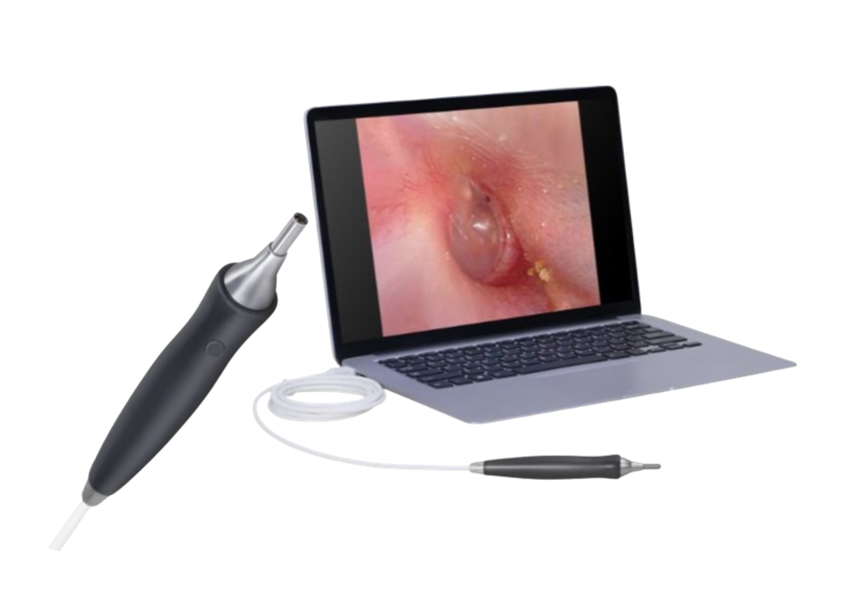 USB Videoscope